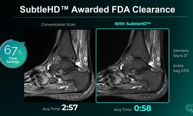 AI-Powered MRI Enhancement Software Gets FDA Green Light