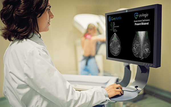FDA Clears AI Tool for Use with GE HealthCare Mammography Systems