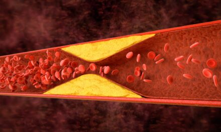 AI-Driven Coronary Physiology Software Gains FDA Clearance