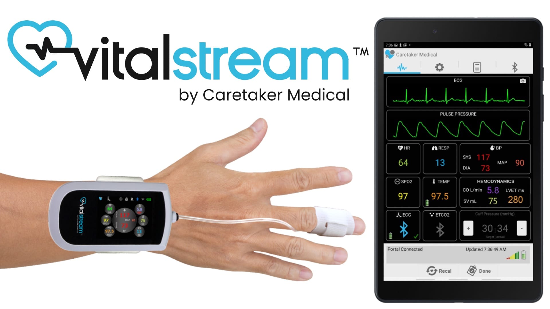 Company Advancing Wireless Blood Pressure Monitoring Wins Innovation Grant