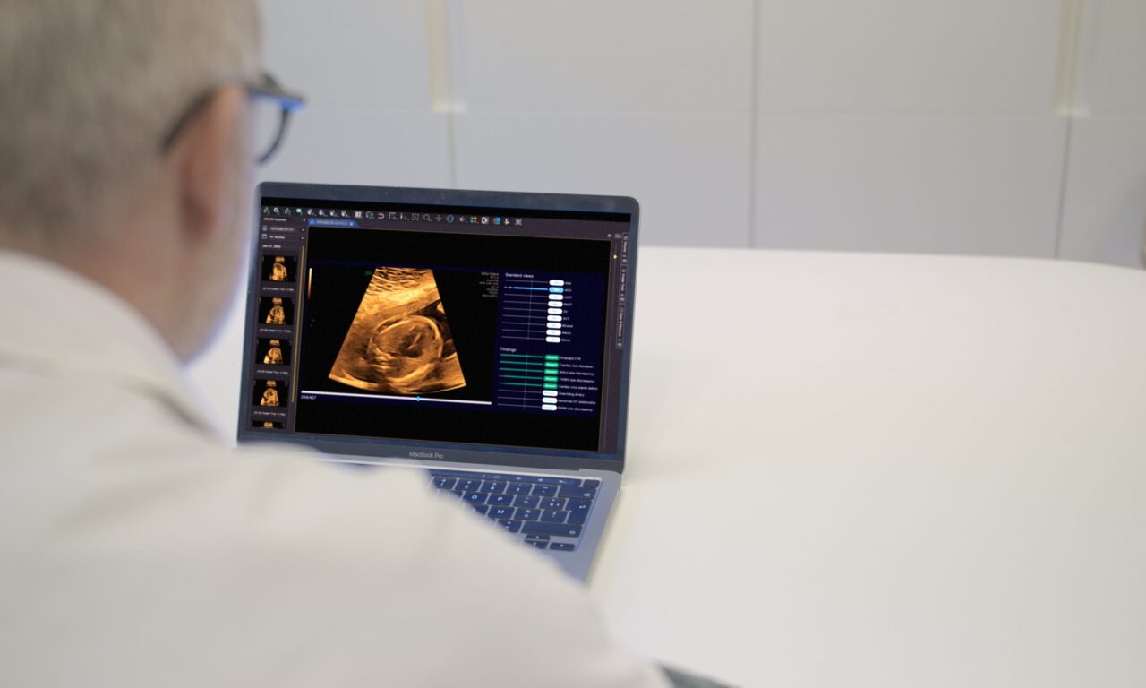 FDA Clears AI Tool to Assist with Fetal Heart Ultrasound Scans
