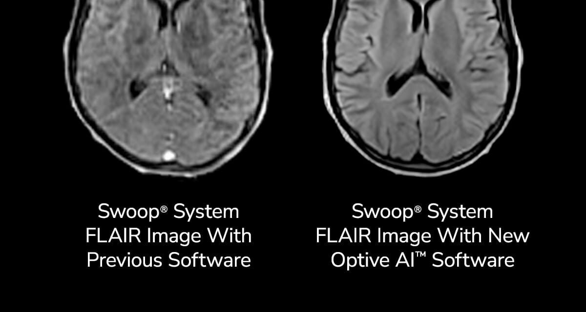 FDA Clears Next-Gen Software for AI-Enabled Portable Brain MRI