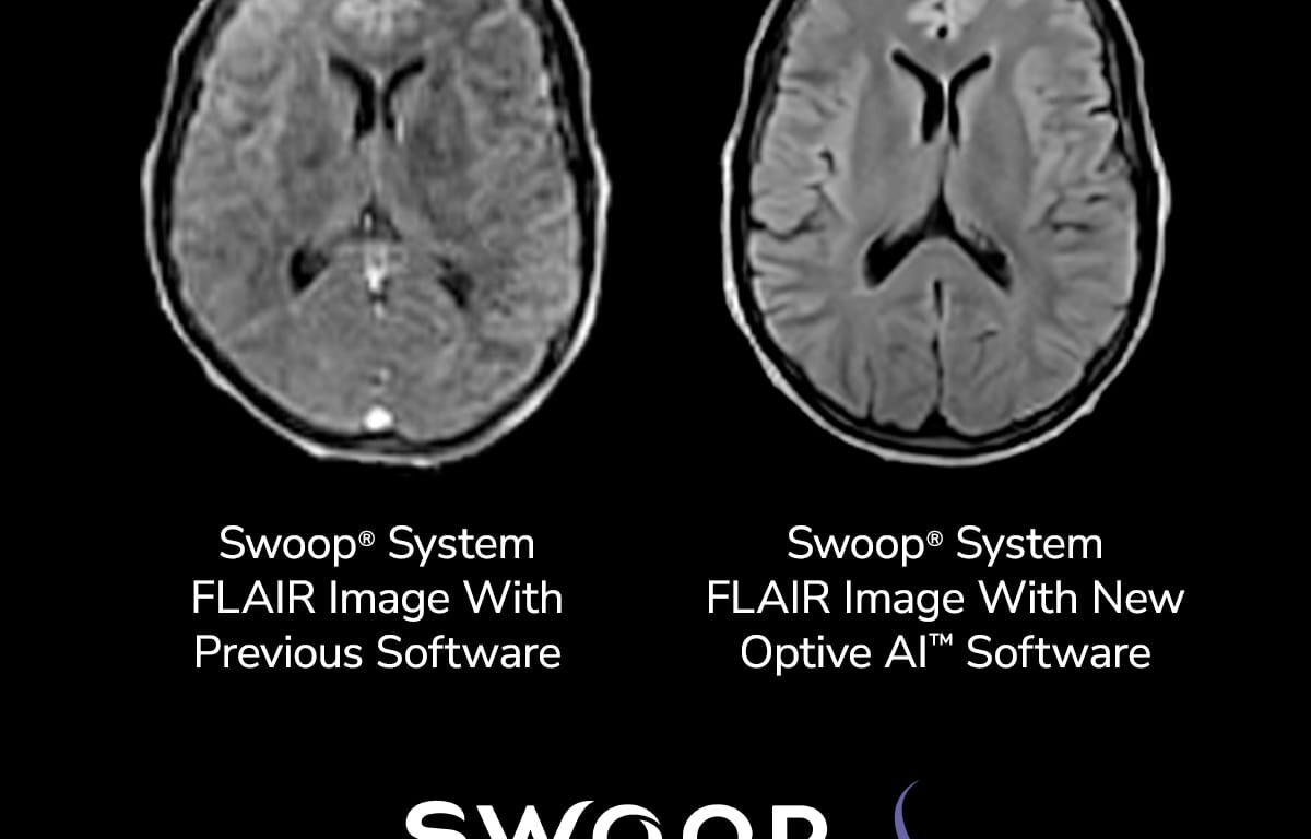 FDA Clears Next-Gen Software for AI-Enabled Portable Brain MRI