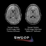 FDA Clears Next-Gen Software for AI-Enabled Portable Brain MRI