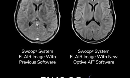 FDA Clears Next-Gen Software for AI-Enabled Portable Brain MRI
