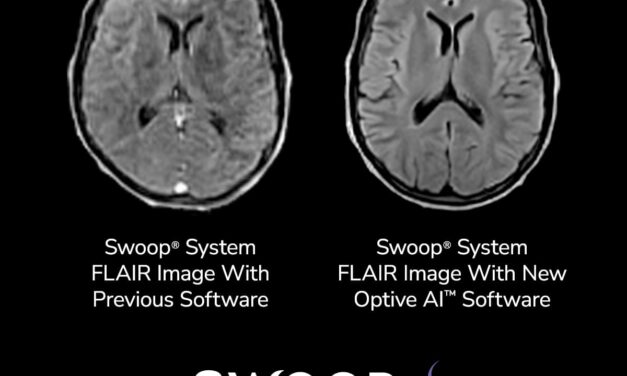 FDA Clears Next-Gen Software for AI-Enabled Portable Brain MRI