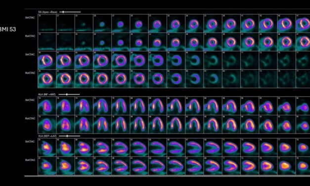 GE HealthCare Expands Access to Cardiac PET with Flurpiridaz F 18