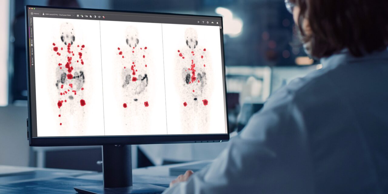 GE HealthCare Showcases Theranostics Portfolio and Imaging Advances at SNMMI 2025