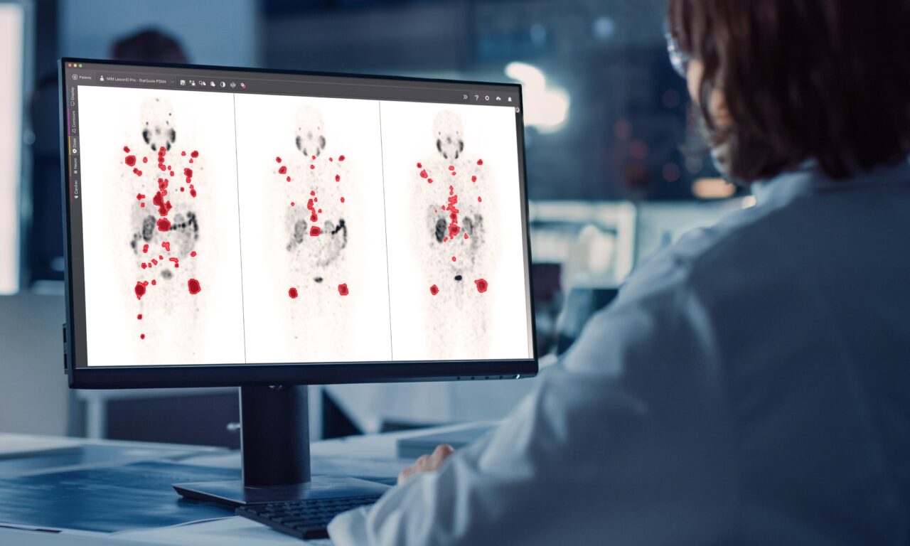 GE HealthCare Showcases Theranostics Portfolio and Imaging Advances at SNMMI 2025