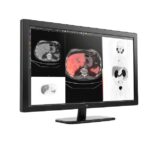 GE HealthCare Integrates MIM Encore Platform to Expand Digital Imaging and Workflow Tools