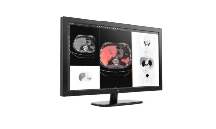 GE HealthCare Integrates MIM Encore Platform to Expand Digital Imaging and Workflow Tools