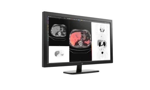 GE HealthCare Integrates MIM Encore Platform to Expand Digital Imaging and Workflow Tools