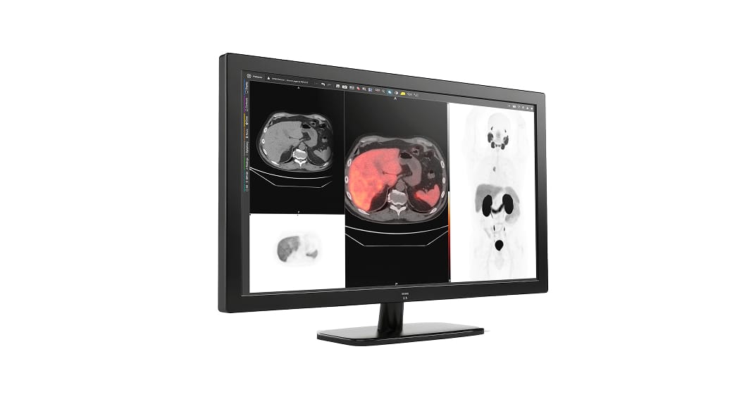 GE HealthCare Integrates MIM Encore Platform to Expand Digital Imaging and Workflow Tools