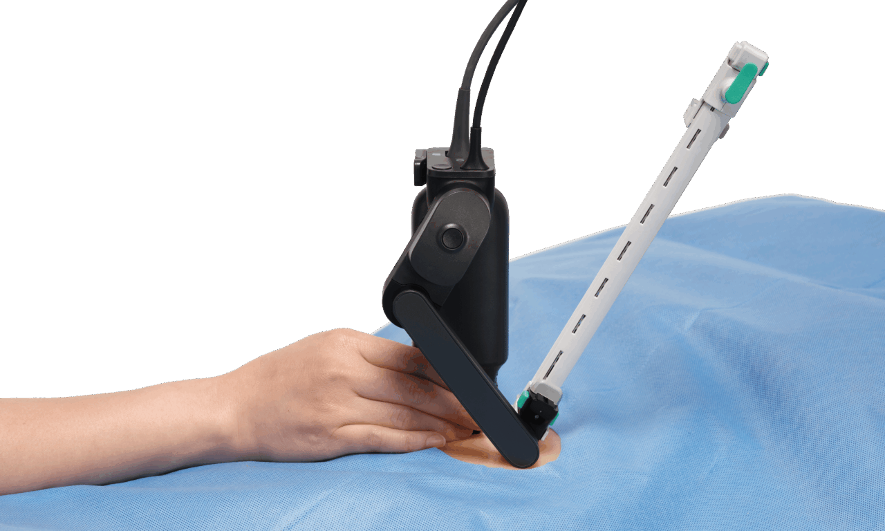 FDA Clears Handheld Robotic System for Ultrasound-Guided Needle Placement