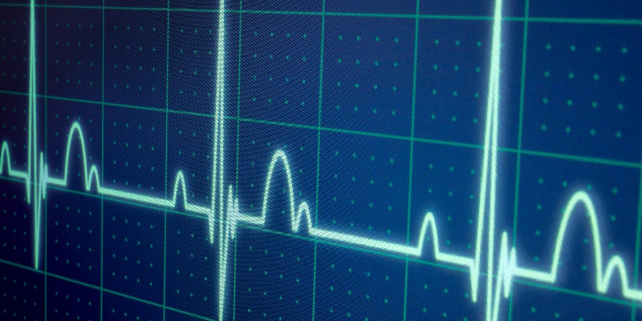 FDA Clears AI Tool for Detecting Low Ejection Fraction from ECGs