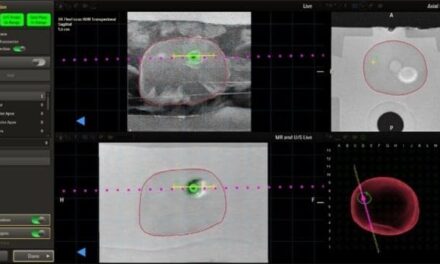 Philips Receives FDA Clearance for Image-Guided Prostate Cancer Solution