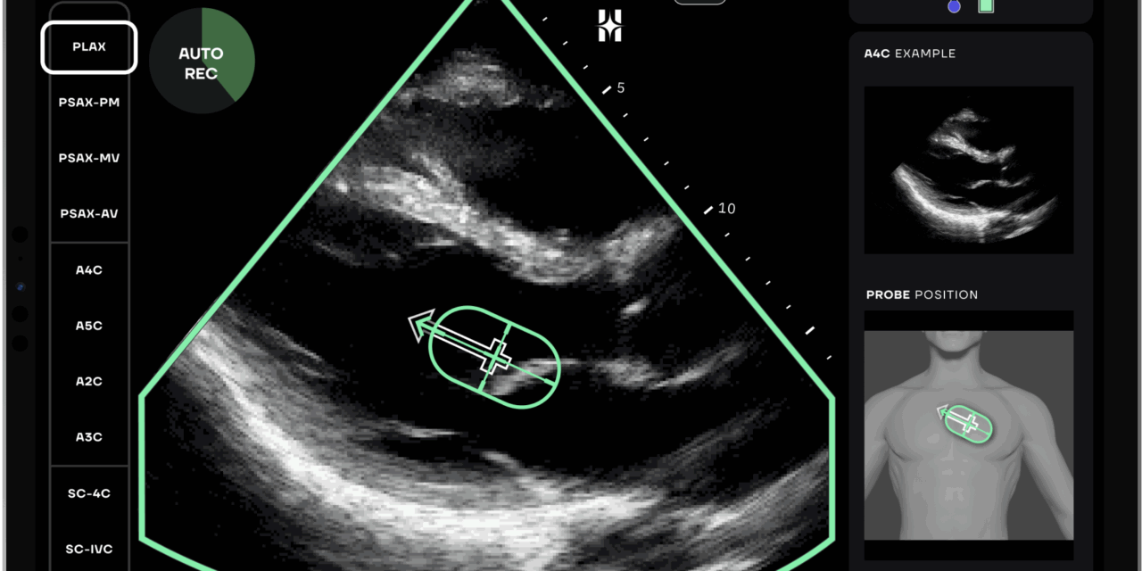 HeartFocus Launches AI Cardiac Imaging Software in US with Butterfly Network