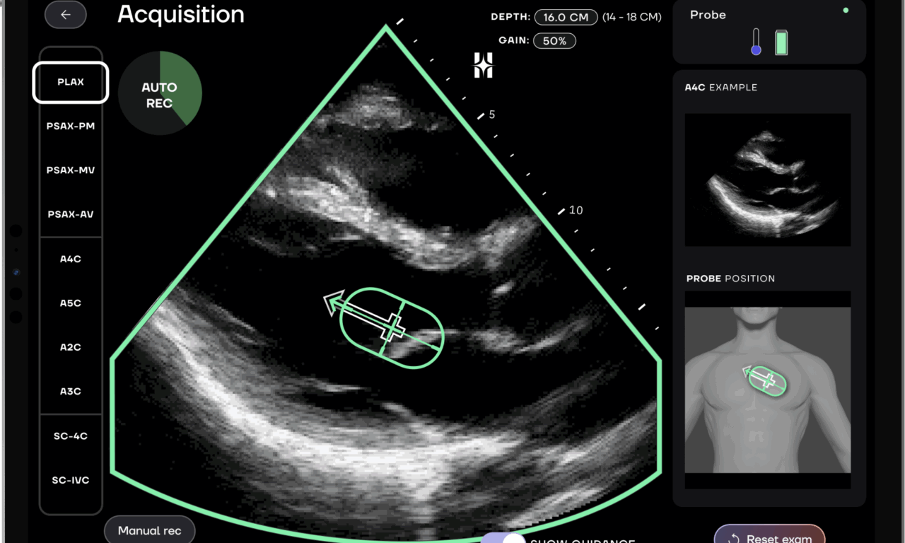 HeartFocus Launches AI Cardiac Imaging Software in US with Butterfly Network
