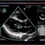 HeartFocus Launches AI Cardiac Imaging Software in US with Butterfly Network