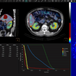 FDA Clears Updated Hermia Voxel Dosimetry Software
