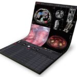 New MedDream DICOM Viewer Now Available Through Aycan