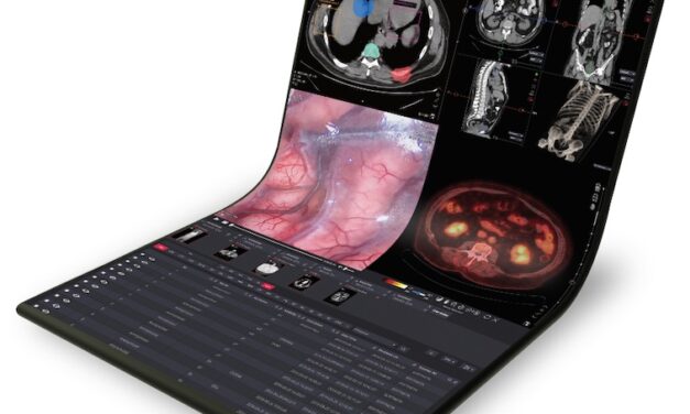 New MedDream DICOM Viewer Now Available Through Aycan