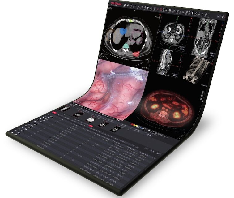 New MedDream DICOM Viewer Now Available Through Aycan