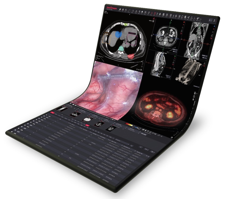 New MedDream DICOM Viewer Now Available Through Aycan