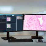 Health System Adopts Cloud-Based Pathology PACS Solution