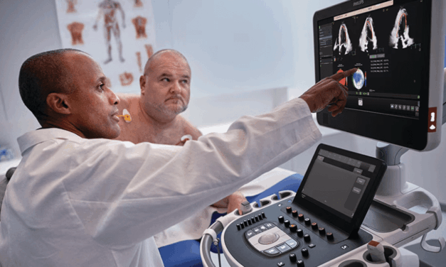 Philips Releases AI-Enhanced Cardiovascular Ultrasound Platform