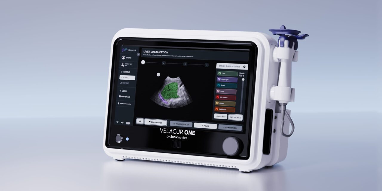 FDA Clears AI-Guided Point of Care Ultrasound for Chronic Liver Diseases