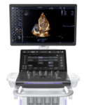 AI-Enhanced Cardiovascular Ultrasound Launches With 4D Imaging Capabilities