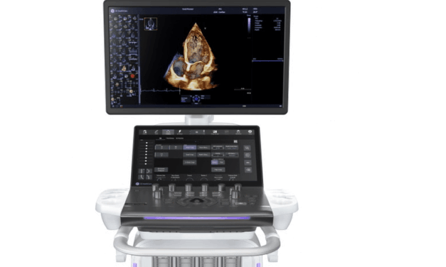 AI-Enhanced Cardiovascular Ultrasound Launches With 4D Imaging Capabilities