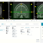 ScanLab Unveils New SNR Calculator for MRI Education