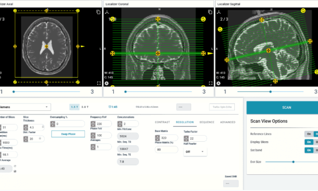 ScanLab Unveils New SNR Calculator for MRI Education