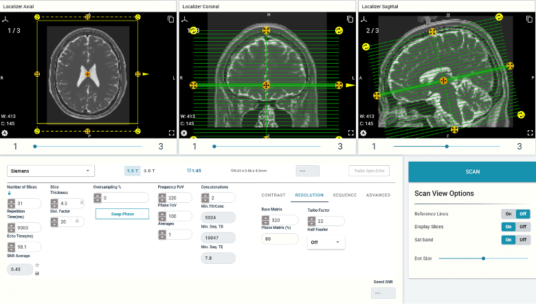 ScanLab Unveils New SNR Calculator for MRI Education