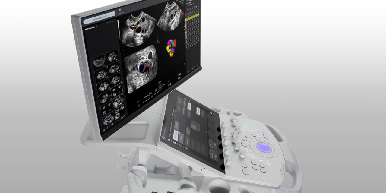 GE HealthCare Launches AI-Enabled Ultrasound Series for Women’s Health