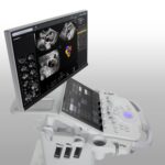 GE HealthCare Launches AI-Enabled Ultrasound Series for Women’s Health