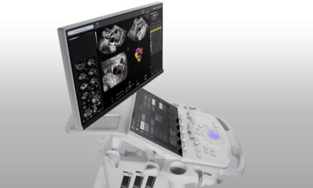 GE HealthCare Launches AI-Enabled Ultrasound Series for Women’s Health