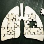 Imaging-Robotics Integration Shows Promise for Earlier Lung Cancer Diagnosis