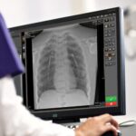 Carestream Updates Radiography Imaging Software to Support More Confident Diagnoses