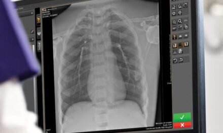 Carestream Updates Radiography Imaging Software to Support More Confident Diagnoses