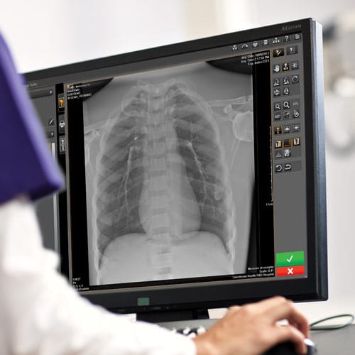 Carestream Updates Radiography Imaging Software to Support More Confident Diagnoses
