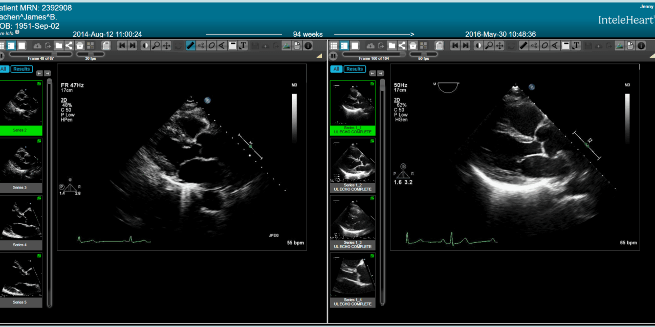 Next-Gen Cardiology Platform Consolidates Imaging, Reporting, and Workflows