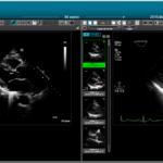 Next-Gen Cardiology Platform Consolidates Imaging, Reporting, and Workflows