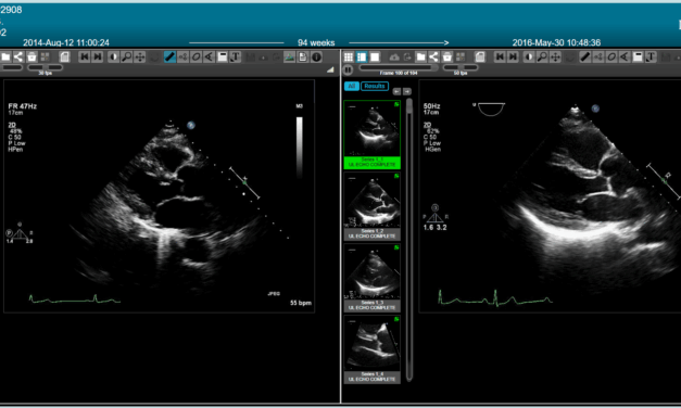 Next-Gen Cardiology Platform Consolidates Imaging, Reporting, and Workflows