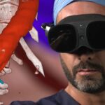 Surgical XR Visualization Platform Surpasses 50,000 Uses