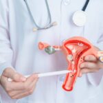 U of A Biomedical Engineer Wins $3M for Tiny Microscope to Detect Endometriosis