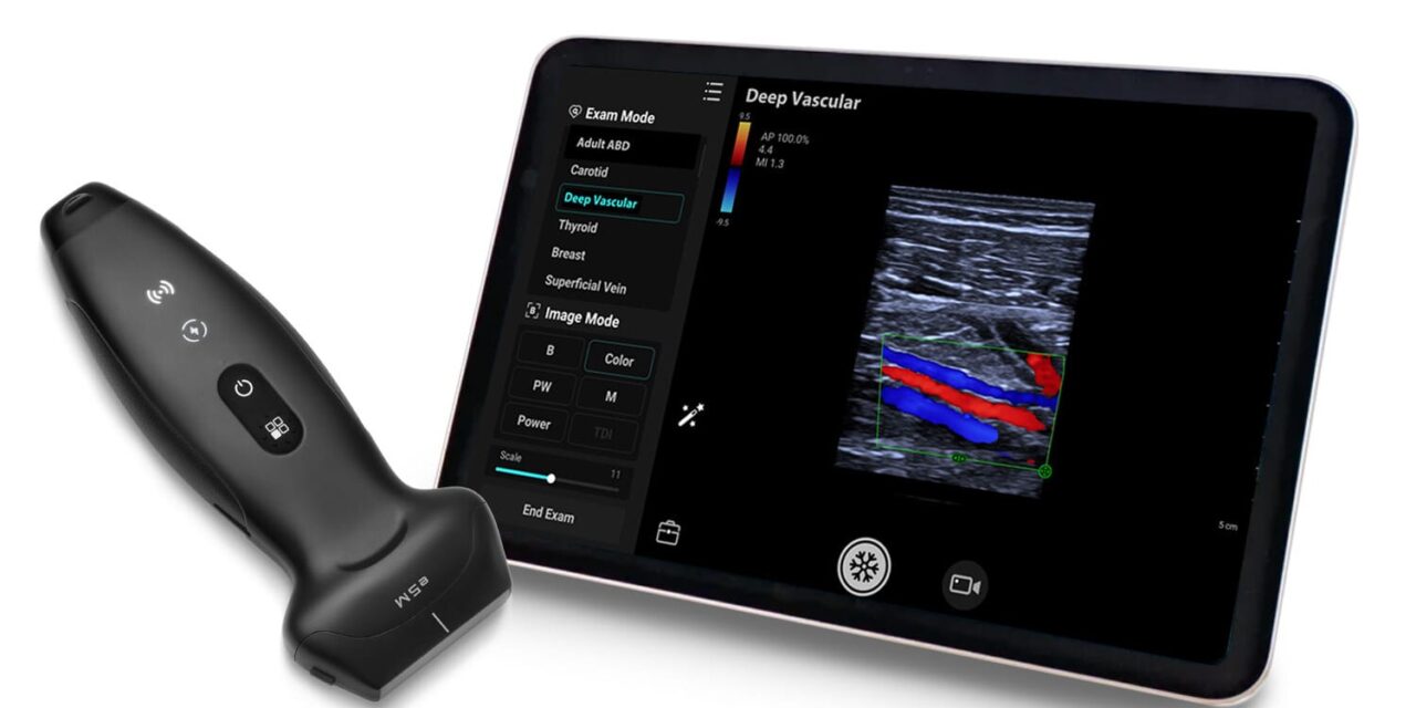 Mindray Launches New Wireless Handheld Ultrasound for Whole-Body Scanning