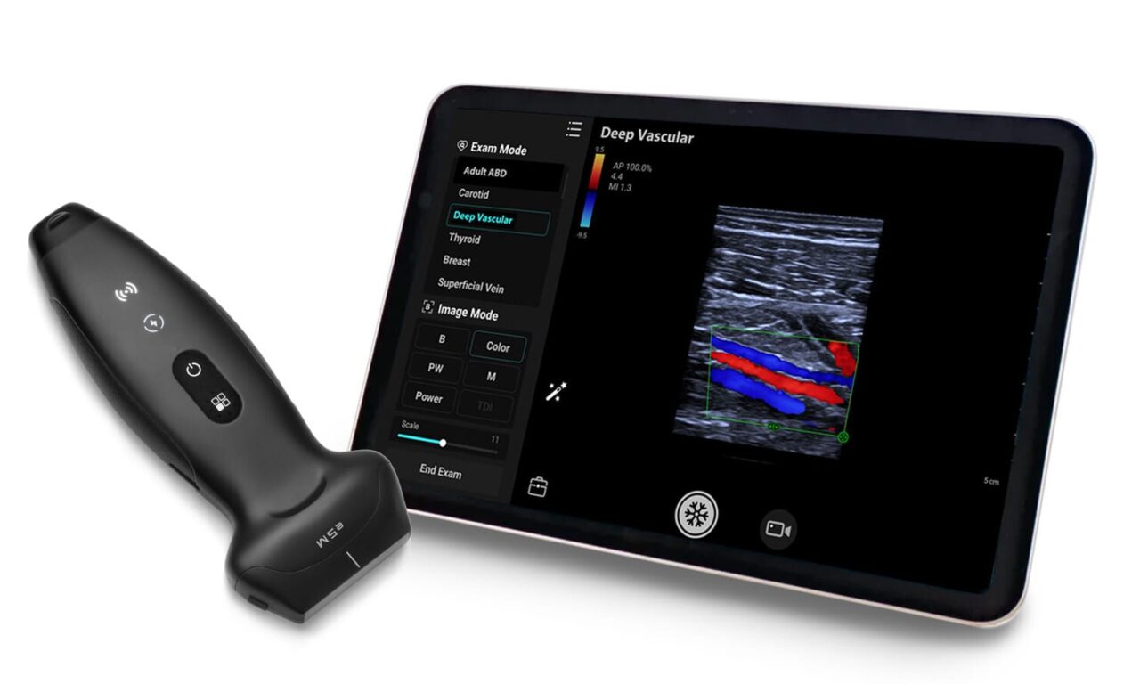 Mindray Launches New Wireless Handheld Ultrasound for Whole-Body Scanning